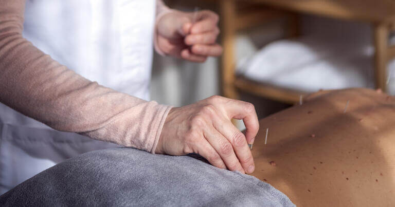 Beneficios de la Acupuntura para la Fertilidad - Marta Heredia